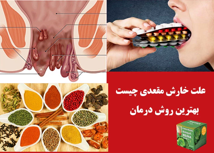 علت خارش مقعدی 