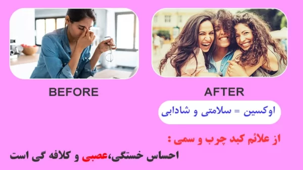 از علائم کبد چرب خستگی و کلافه گی است