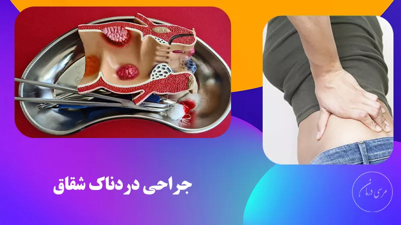 عمل زخم مقعد با دستگاه لیزر چقدر دردناک است